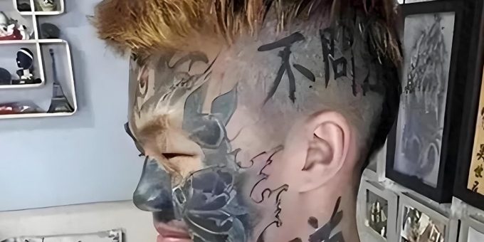 纹面男孩已洗3次纹身